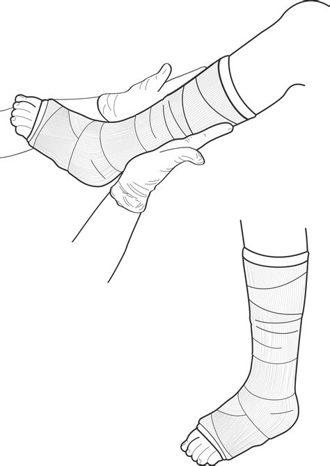 Clipart - Leg Cast