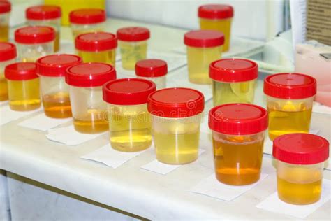 Preparación De Muestras De Orina En El Laboratorio En El Hospital Para