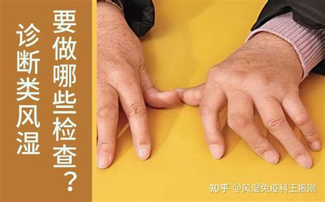 一文读懂诊断类风湿关节炎，患者要做哪些检查 知乎