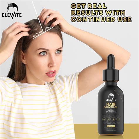 ELEVATE Hair Growth Oil Biotin Hair Growth Serum 5 Minoxidil