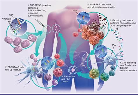 Figure 1 From Development Of Prostvac Immunotherapy In Prostate Cancer