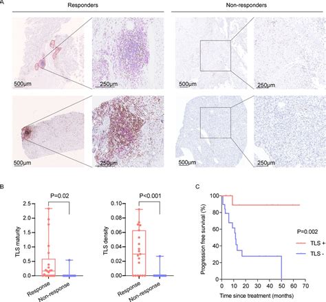 Integrated Analysis Of Tertiary Lymphoid Structures And Immune