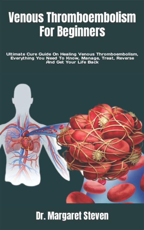 Buy Venous Thromboembolism For Beginners Ultimate Cure Guide On