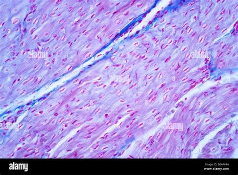 Cardiac Muscle Micrograph Hi Res Stock Photography And Images Alamy