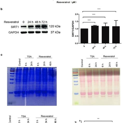 Effects Of Resveratrol On Cell Viability SIRT1 Expression And Global