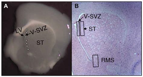 Frontiers Embryonic Cerebrospinal Fluid Increases Neurogenic Activity