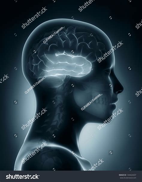 Female Temporal Lobe Medical Xray Scan Stock Illustration 134424437