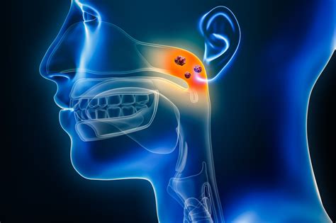 FDA Approves First Treatment for Nasopharyngeal Carcinoma