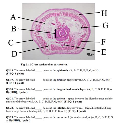 Earthworm Cross Section Labeled