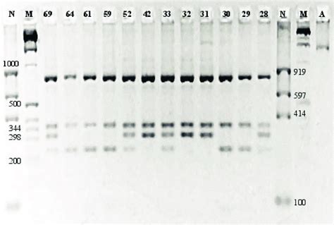 Reverse Image Of Ethidium Bromide Stained Agarose Gel Indicating