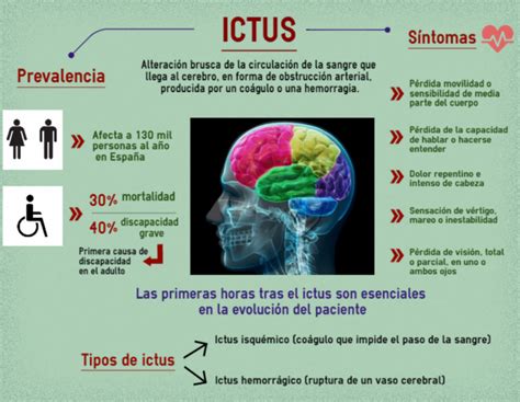 Arteria Cerebral Media Izquierda El Riesgo De Ictus Y La Importancia