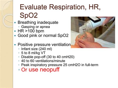 16 Neonatal Resuscitation Ppt