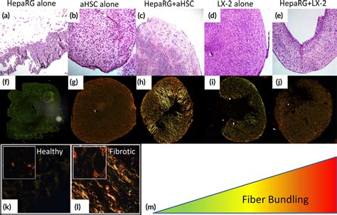 Histological Analysis Of Liver Organoids Different Types Of Liver