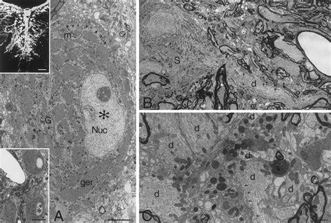 Light And Electron Microscopic Visualization Of Oculomotor Motoneurons