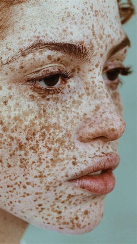 Photographer Captures The Beauty Of Freckles In All Their Glory Artofit