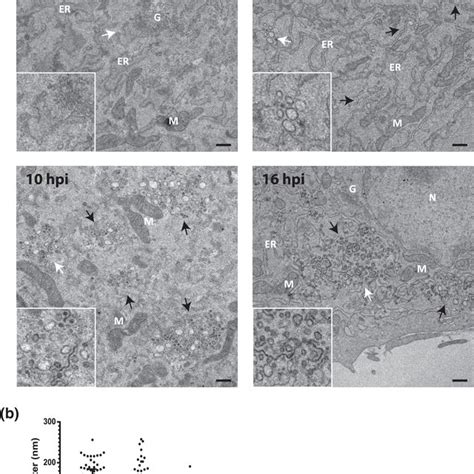 Ultrastructural Analysis Of E Derm Infected Cells At Hr Pi Using