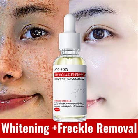 Melasma Facial Serum Whitening Dark Spots Freckle Removal With