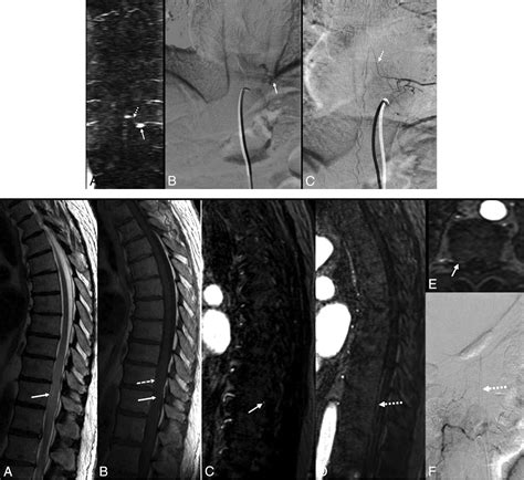 Fig 3 Comparison Of Time Resolved And First Pass Contrast Enhanced