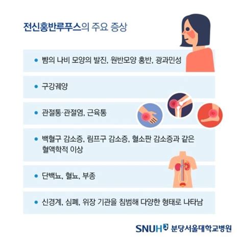 생생건강정보 건선·뺨 발진도 자가면역질환면역세포의 공격 왜 파이낸셜뉴스