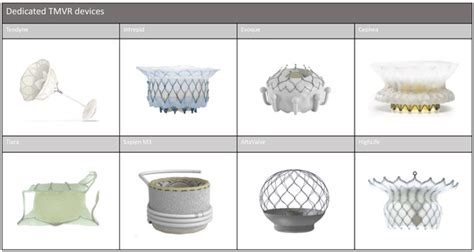 Transcatheter Mitral Valve Replacement Using Tr