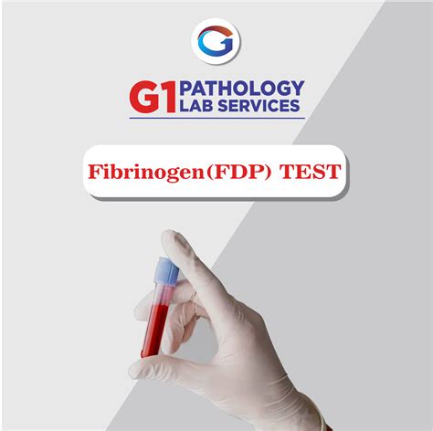 Fibrinogen Test