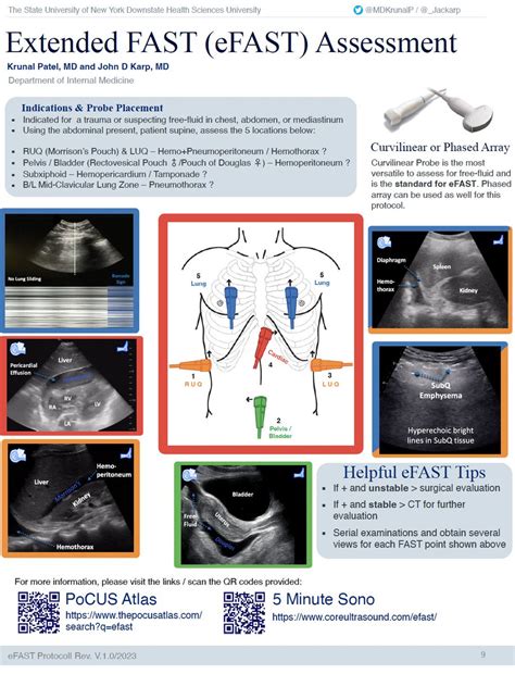 ICU OnePager On Twitter Cool POCUS OnePagers