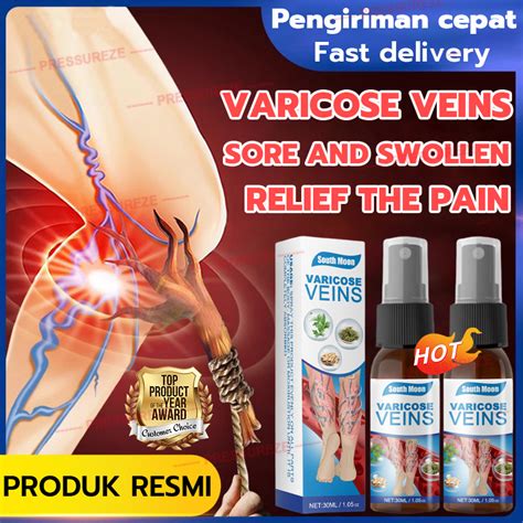 Varicose Veins Spray Effective Remover Varicose Veins Plaster Pain