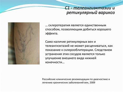 Нарушение венозного кровообращения конечностей - презентация онлайн