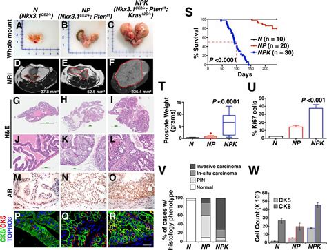 Etv Promotes Metastasis In Response To Activation Of Pi Kinase And