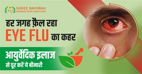 हर जगह फ़ैल रहा Eye Flu का कहर आयुर्वेदिक इलाज से दूर करें ये बीमारी