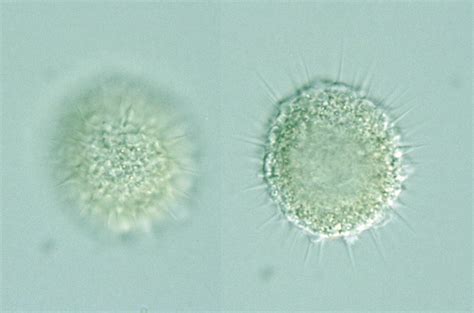 Protist Images Actinophrys