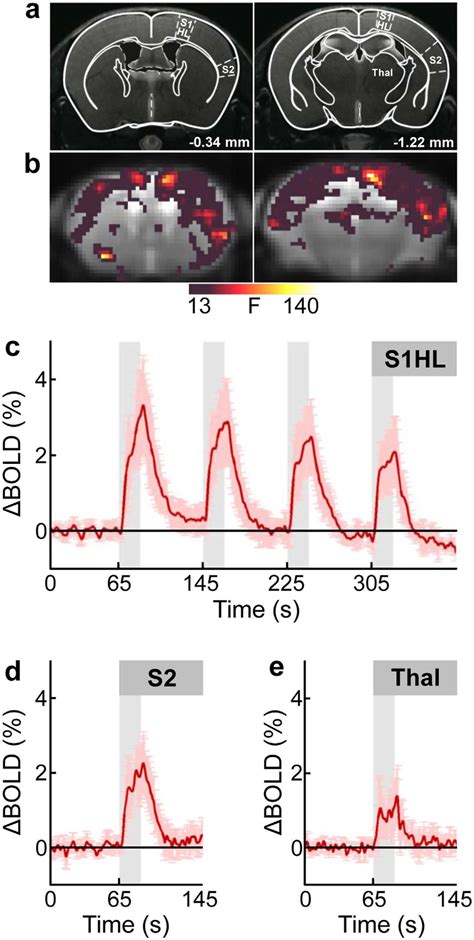 Bold Fmri Of Neural Activation Elicited By Unilateral Electrical