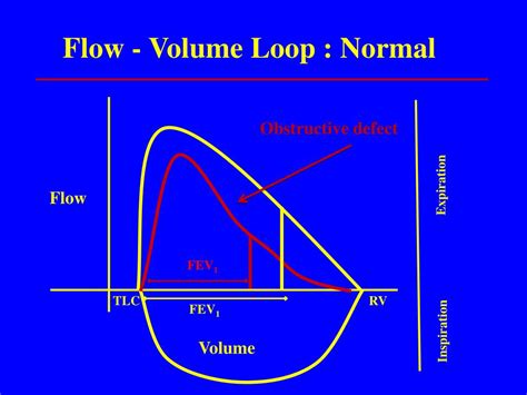 Ppt Asthma In Children Managing The Uncertainty Principle Powerpoint