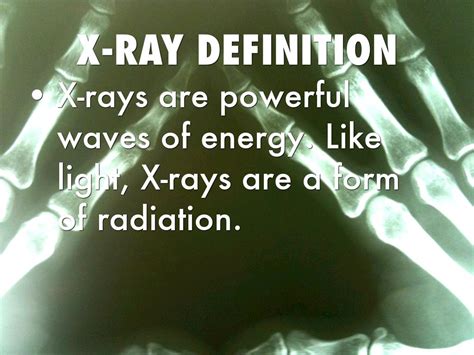 X Rays By Brynlee Pollock