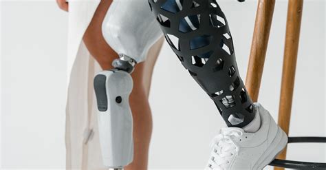 Woman and a Man with a Prosthetic Legs · Free Stock Photo