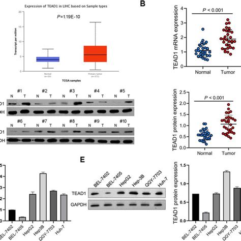 Tead Promotes Proliferation Migration And Invasion In Hcc Cells