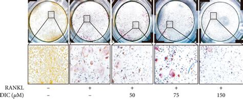 Dictamnine Suppresses Rankl Induced Osteoclast Differentiation With No Download Scientific