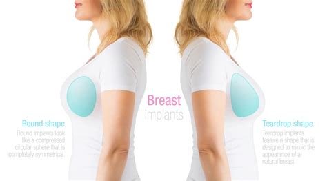 Why Breast Surgery Patients Should Consider Teardrop Implants | Health ...