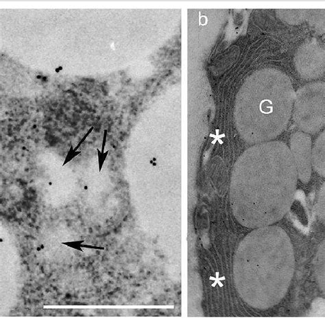 Portions Of Acinar Serous Cells In Untreated Parotid Gland Staining For