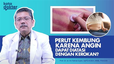 Apakah Perut Kembung Dapat Diatasi Dengan Kerokan Kata Dokter Youtube