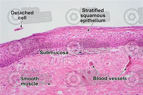 Woman Vagina Transverse Section X Man Mammals Reproductive