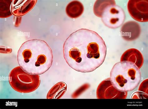 Protozoan Plasmodium falciparum in the stage of ring form tr Stock ...