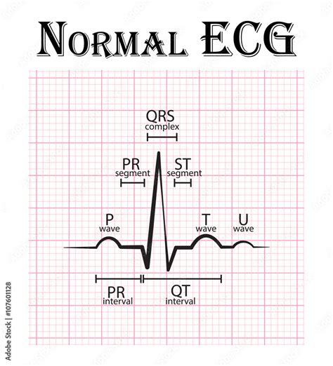 Vetor Do Stock Normal ECG Electrocardiogram P Wave PR Segment