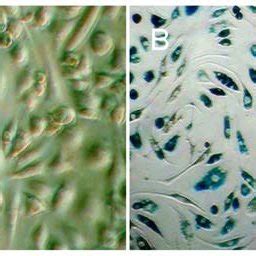 EPCs Showed Endothelium Like Cobblestone Morphology With Characteristic