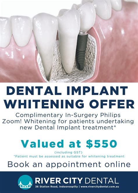 Brisbane Dentist Offers | Dentist Indooroopilly | River City Dental