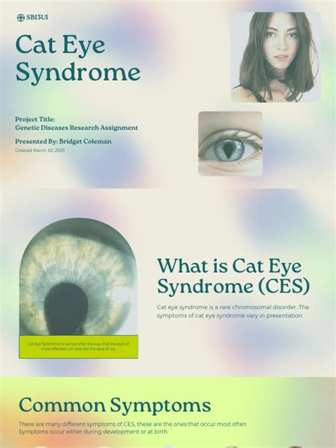 Cat Eye Syndrome | PDF | Diseases And Disorders | Clinical Medicine