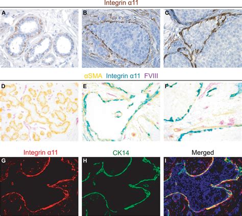 Integrin α11 is expressed in a subgroup of breast myoepithelial cells