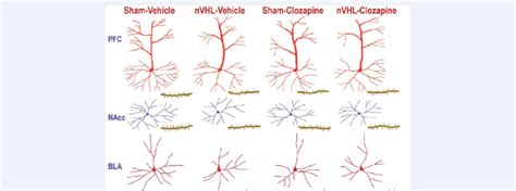 This Figure Displays Alterations In Dendritic Arborization And Spine