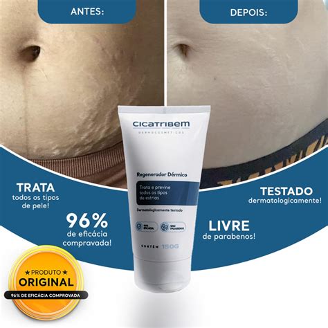 Loja Oficial Cicatribem Creme Anti Estrias Tratamento Eficaz 150g O