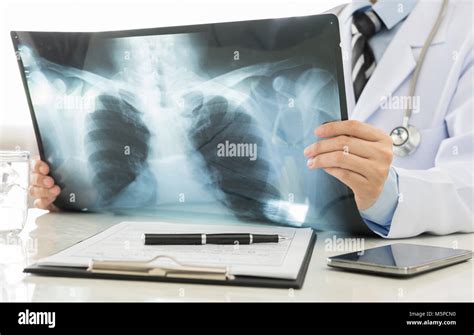 Doctor Holding X Ray Or Roentgen Image In Hospital Stock Photo Alamy